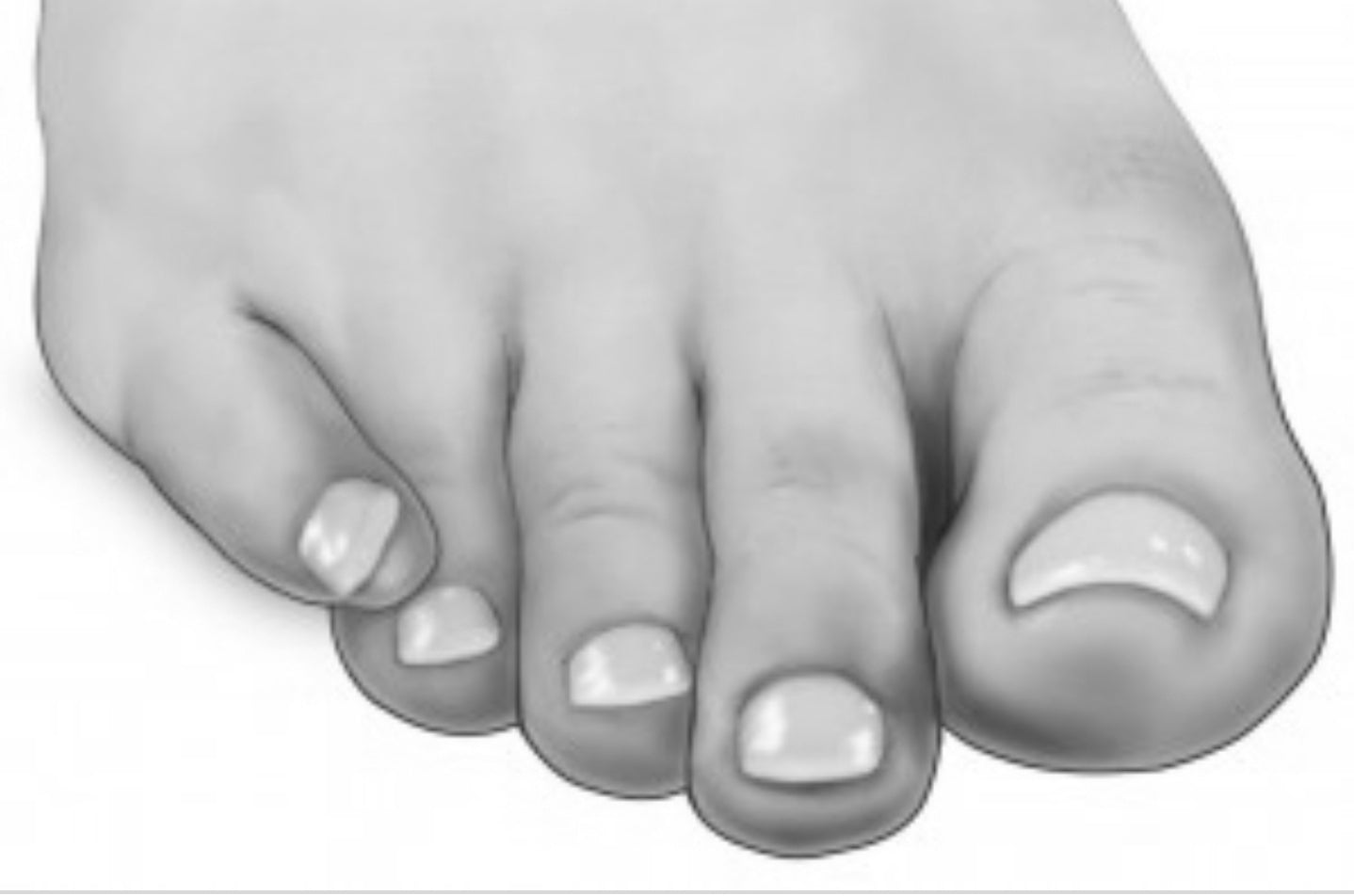 Deez Silicone Pinky Toe Separator