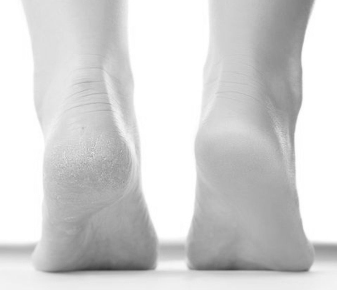 Deez Silicone Heel Sleeves