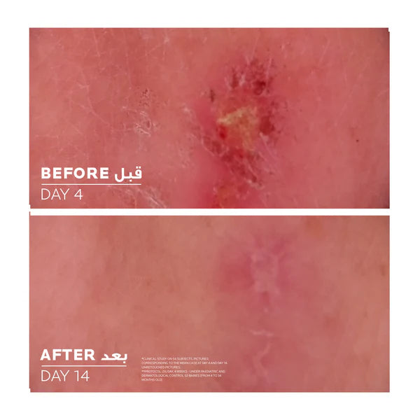 La Roche-Posay Cicaplast Baume B5+ 40ml â Baume multi-rĂ©parateur apaisant, enrichi en vitamine B5 et beurre de karitĂ©, pour protĂ©ger et rĂ©gĂ©nĂ©rer les peaux irritĂ©es et fragilisĂ©es