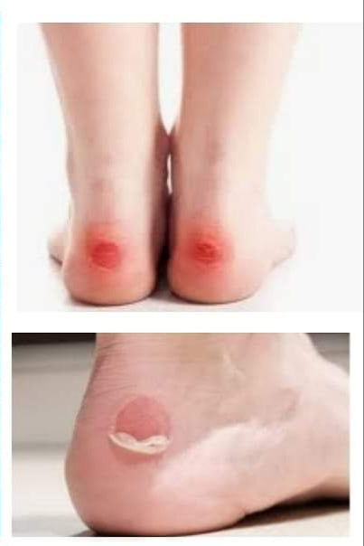 Deez Silicone Heel Strips